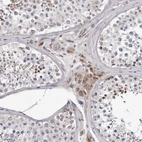 Immunohistochemical staining of human testis shows strong cytoplasmic positivity in Leydig cells.