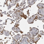 Immunohistochemical staining of human lung shows strong cytoplasmic positivity in macrophages.