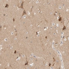 Immunohistochemical staining of human cerebral cortex shows cytoplasmic positivity in neuronal cells.