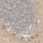 Immunohistochemical staining of human cerebellum shows cytoplasmic positivity in Purkinje cells.