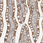 Immunohistochemical staining of human small intestine shows cytoplasmic positivity in glandular cells.