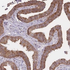 Immunohistochemical staining of human fallopian tube shows moderate cytoplasmic positivity in glandular cells.