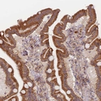 Immunohistochemical staining of human duodenum shows strong cytoplasmic positivity in glandular cells.