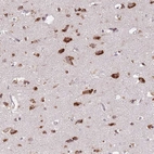 Immunohistochemical staining of human cerebral cortex shows strong cytoplasmic positivity in neuronal cells.