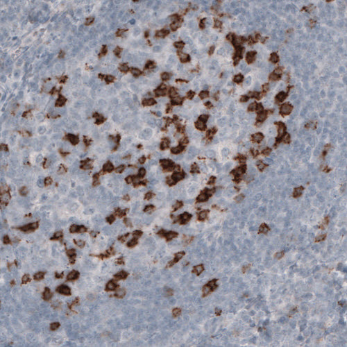 Anti-PDCD1 Antibody