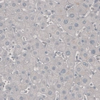 Immunohistochemical staining of human liver shows absence of immunoreactivity (negative control).