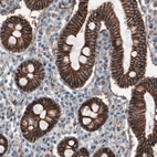 Immunohistochemical staining of human duodenum shows strong membranous immunoreactivity in epithelial cells.