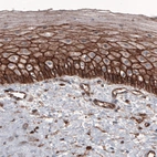 Immunohistochemical staining of human cervix shows strong membranous positivity in epithelial cells.