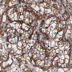 Anti-CTNNB1 Antibody