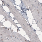 Immunohistochemical staining of human skeletal muscle shows absence of immunoreactivity in muscle fibers (negative control).