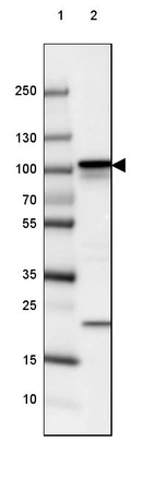 Lane 1: Marker [kDa] 250, 130, 100, 70, 55, 35, 25, 15, 10_br/_Lane 2: Human cell line SK-MEL-30