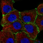 Immunofluorescence staining of A-431 cells using the Anti-CTNNB1 monoclonal antibody, showing specific staining in the plasma membrane in green. Microtubule- and nuclear probes are visualized in red and blue, respectively (where available).