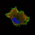 Immunofluorescence staining of U-251 cells using the Anti-CTNNB1 monoclonal antibody, showing specific staining in the plasma membrane in green. Microtubule- and nuclear probes are visualized in red and blue, respectively (where available).