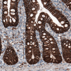 Anti-CTNNB1 Antibody