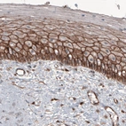Immunohistochemical staining of human cervix shows strong membranous positivity in epithelial cells.