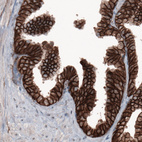 Immunohistochemical staining of human prostate shows membranous immunoreactivity in epithelial cells.