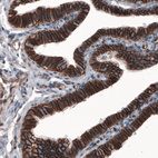 Anti-CTNNB1 Antibody