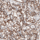 Anti-CTNNB1 Antibody