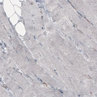 Immunohistochemical staining of human skeletal muscle shows absence of immunoreactivity in muscle fibers (negative control).