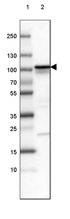 Lane 1: Marker [kDa] 250, 130, 100, 70, 55, 35, 25, 15, 10_br/_Lane 2: Human cell line SK-MEL-30
