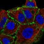 Anti-CTNNB1 Antibody