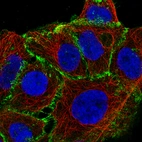 Immunofluorescence staining of A-431 cells using the Anti-CTNNB1 monoclonal antibody, showing specific staining in the plasma membrane in green. Microtubule- and nuclear probes are visualized in red and blue, respectively (where available).