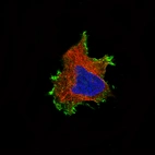 Immunofluorescence staining of U-251 cells using the Anti-CTNNB1 monoclonal antibody, showing specific staining in the plasma membrane in green. Microtubule- and nuclear probes are visualized in red and blue, respectively (where available).