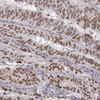 Anti-SNAI1 Antibody