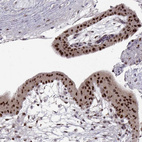 Anti-SNAI1 Antibody