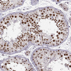 Anti-SNAI1 Antibody