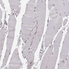 Anti-SNAI1 Antibody