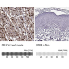 Anti-CDH2 Antibody