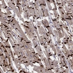Immunohistochemical staining of human heart muscle shows strong positivity in the intercalated discs of cardiomyocytes.