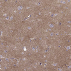 Anti-CDH2 Antibody