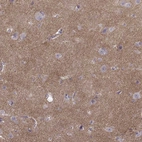 Immunohistochemical staining of human cerebral cortex shows moderate positivity in neuropil.