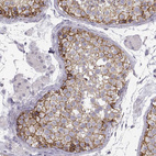 Anti-CDH2 Antibody