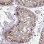 Immunohistochemical staining of human testis shows strong membranous positivity in cells in seminiferous ducts.