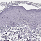 Immunohistochemical staining of human skin shows no positivity in epidermal cells as expected.