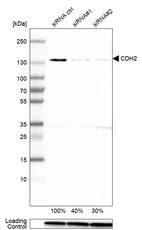 Western blot analysis in U-251MG cells transfected with control siRNA, target specific siRNA probe #1 and #2, using Anti-CDH2 antibody. Remaining relative intensity is presented. Loading control: Anti-GAPDH.