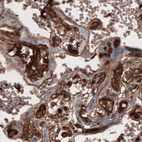 Immunohistochemical staining of human placenta shows strong immunoreactivity in chorionic villi.