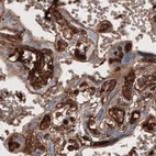 Immunohistochemical staining of human placenta shows strong immunoreactivity in chorionic villi.