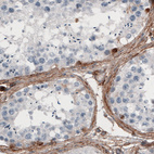 Immunohistochemical staining of human testis shows immunoreactivity in the connective tissue surrounding seminiferous tubules.