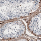 Immunohistochemical staining of human testis shows immunoreactivity in the connective tissue surrounding seminiferous tubules.