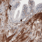 Immunohistochemical staining of human prostate shows moderate positivity in smooth muscle.