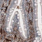 Immunohistochemical staining of human small intestine shows strong immunoreactivity in the connective tissue.