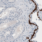 Anti-TP63 Antibody