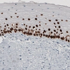 Immunohistochemical staining of human cervix shows strong nuclear immunoreactivity in epithelial cells.