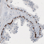 Immunohistochemical staining of human prostate shows nuclear immunoreactivity in basal epithelial cells.