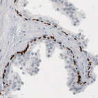 Anti-TP63 Antibody