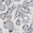 Immunohistochemical staining of human placenta shows nuclear positivity in a subset of cells.